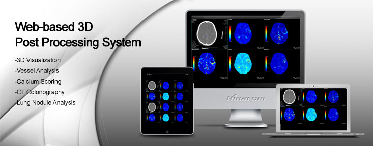 miPlatform3